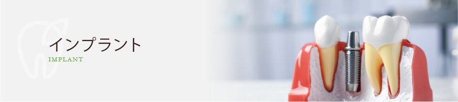 インプラント