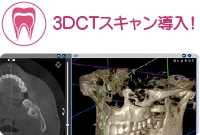 3DCTスキャン導入