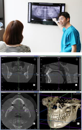 最新鋭CTで高精密な画像診断が可能です
