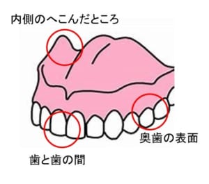 西宮北口　歯医者　入れ歯手入れ
