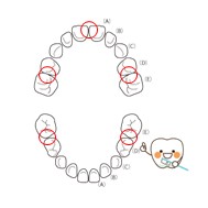 西宮北口　歯医者　仕上げ磨き