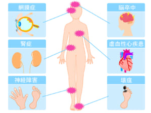 西宮北口　歯医者　糖尿病合併症