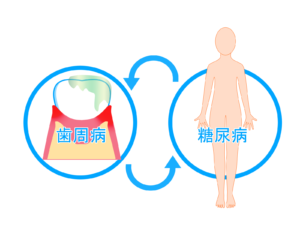 西宮北口　歯医者　糖尿病と歯周病の関係