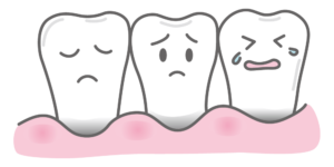 西宮北口　歯医者　歯肉退縮