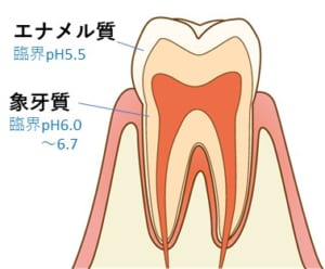 西宮北口　歯医者　臨界pH