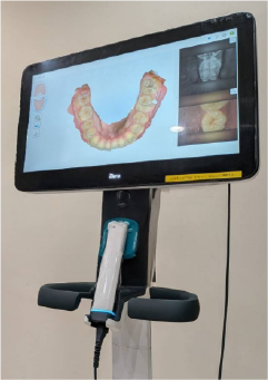 implant_img_2 口腔内スキャナー「iTero Lumina」