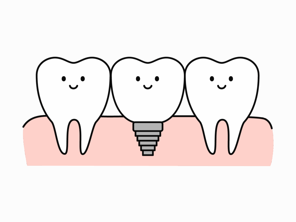 西宮北口 歯医者 インプラント