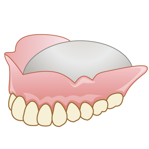 西宮北口 歯医者 総入れ歯