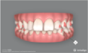 STEP3