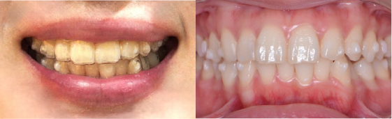 STEP6