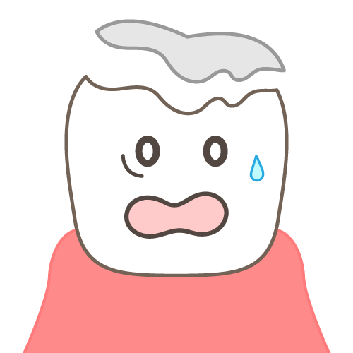 西宮北口　歯医者　詰め物